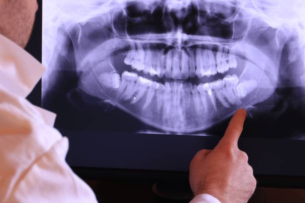Best Emergency Treatment for Dental Infections or Abscesses in Liberty Corner, NJ